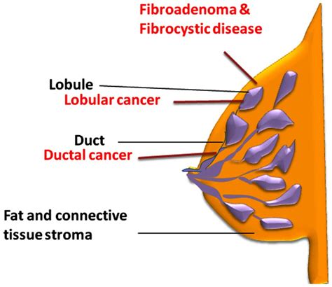The Main Parts Of The Breast Are Lobules Ducts And Stroma Fatty