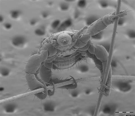 Fei Image Contest 2013 Puts Amazing Electron Microscope Photos In