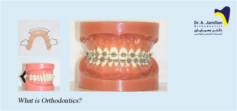 What Is Orthodontics Dr Jamilian Orthodontist