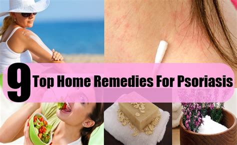 However, as many people with. 9 Top Home Remedies For Psoriasis | Search Home Remedy
