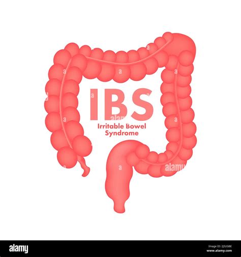 Irritable Bowel Syndrome Ibs Signs Health Messages About Ibs Diagnosis