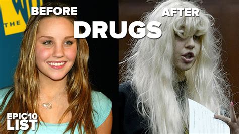 10 Celebrities Before And After Drugs Youtube
