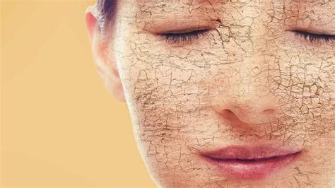 Шелушение кожи причины и лечение шелушения у дерматолога Химки