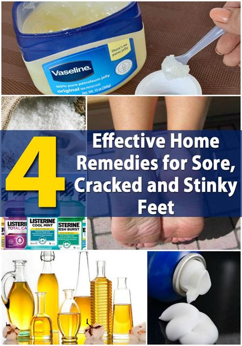 4 Effective Home Remedies For Sore Cracked And Stinky Feet Diy And Crafts