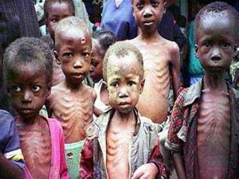 What Are The Different Effects Of Malnutrition Health Cautions