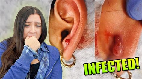 Reacting To Infected Ear Lobe Piercing Youtube