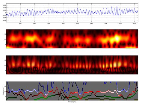 Comparison Of The Spectrogram Wavelet Scalogram And Hilbert Spectrum