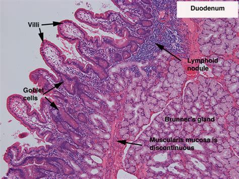 Histology Digestion Small Intestine Flashcards Quizlet Hot Sex Picture