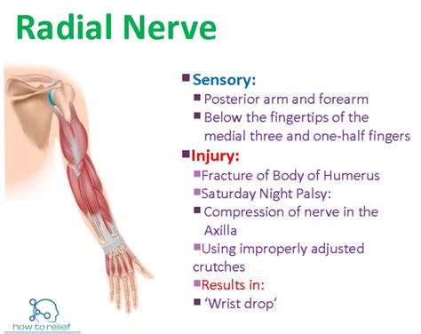 Radial Nerve Common Injuries Radial Nerve Nerve Pain Relief Nerve Pain