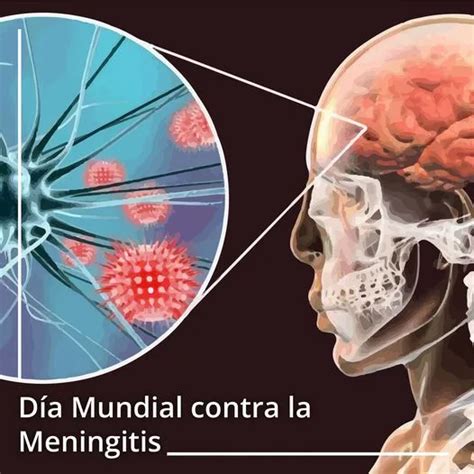El Día Mundial De La Meningitis Se Celebra El 24 De Abril De Cada