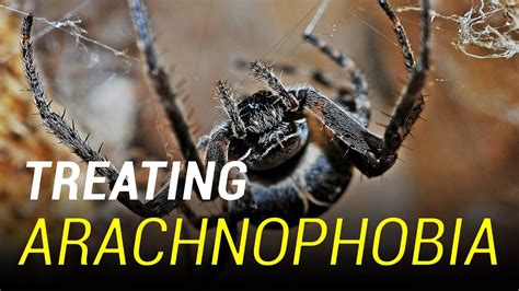 Treating Arachnophobia Spider Phobia Youtube
