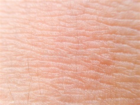 Skin Texture Macro Stock Photo Image Of Rugged Rough 127564914