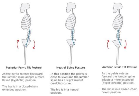 Check spelling or type a new query. Lower Back Pain From Squats? Do THIS | Precision Movement