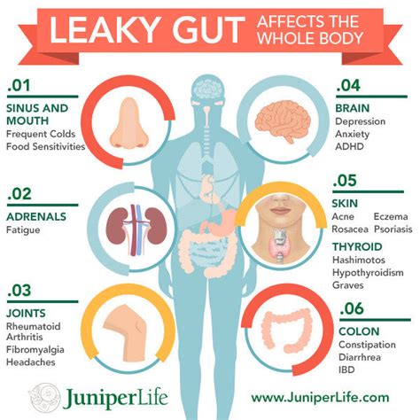 Leaky Gut Syndrome Its More Common Than You Think Mike Butler Fitness