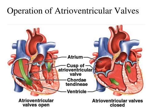 The left atrioventricular valve (lavv) in avsd is a trileaflet valve, composed of the left halves of the superior and inferior bridging leaflets and the left mural leaflet. PPT - The Cardiovascular System: The Heart PowerPoint ...