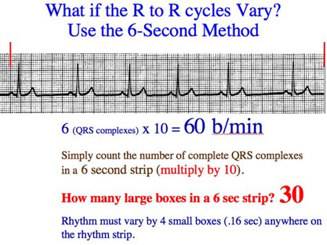 How To Calculate Heart Rate In Atrial Fibrillation Haiper
