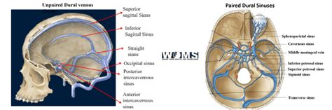 Intracranial Venous Anatomy