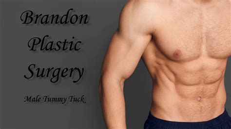 Male Abdominoplasty Surgery Results Youtube