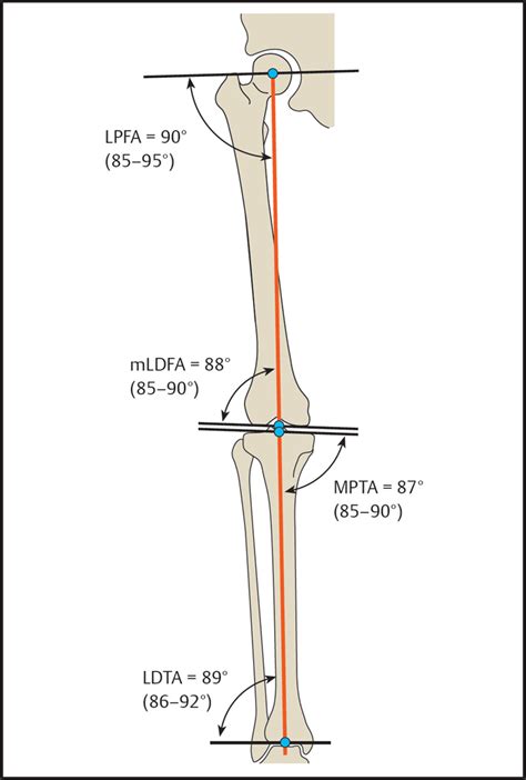 Lower Limb Alignment Radiology Key