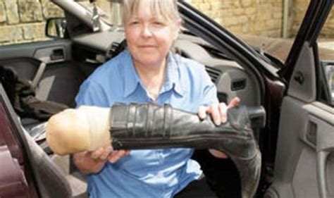 One Legged Wife Loses Disabled Badge Because She Can Hop Uk News