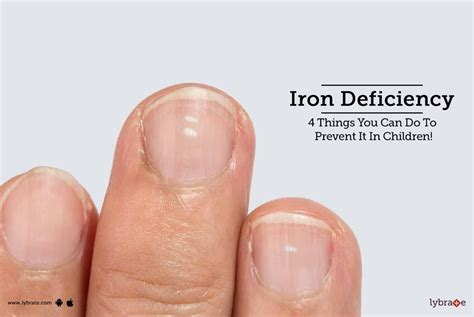 Iron Deficiency 4 Things You Can Do To Prevent It In Children By