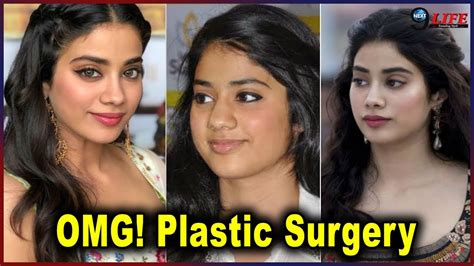 Janhvi Kapoor Plastic Surgery