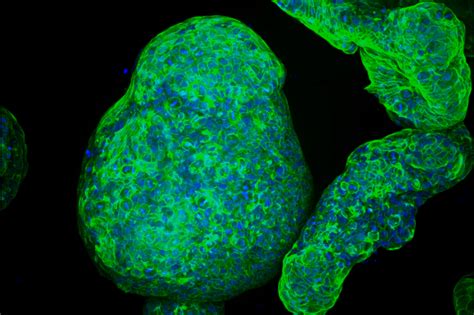 Engineers Grow Pancreatic Organoids That Mimic The Real Thing Mit