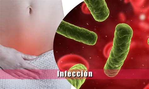 Infección Causas Síntomas Virus Y Bacterias Contagio Tratamiento