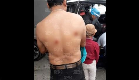 Ladrones Balean A Padre E Hija En Tecamachalco Virtual Noticias