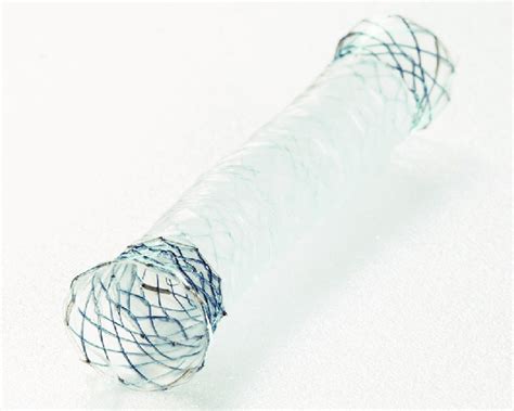 Fully Covered Self Expandable Metal Stent With Anti Migratory Flared
