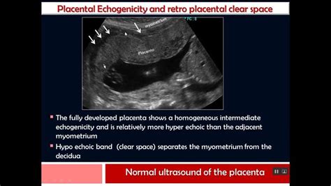 Placenta Lesions Imaging Ultrasound