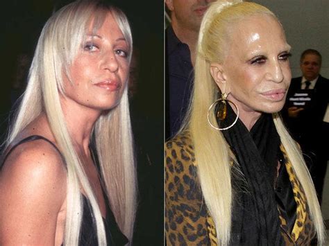 10 Before And After Celebrity Plastic Surgery Fails That Will Scare You