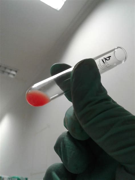 Hemoglobin dari sel darah merah yang dirombak kemudian akan. CARA MEMBUAT SUSPENSI SEL DARAH MERAH - Yazhid Blog