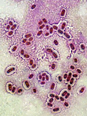 Streptococcus Pneumoniae Stock Image C Science Photo Library