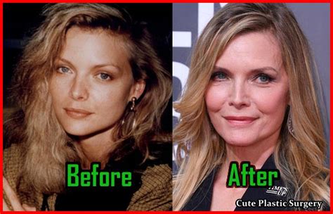 Michelle Pfeiffer Plastic Surgery Celebrities Plastic Surgery
