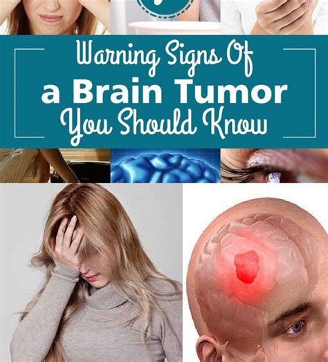 7 Warning Signs Of A Brain Tumor You Should Know Brain Tumor Brain