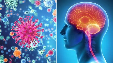 Viral Meningitis Causes Treatment And Prevention Everyday Health