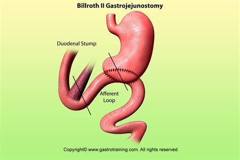 Gastroenterology Education And CPD For Trainees And Specialists