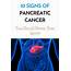 10 Signs Of Pancreatic Cancer You Should Never Ever Ignore