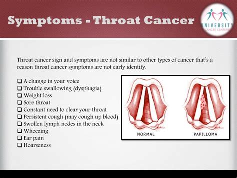 Throat Cancer Symptoms Signs Of Throat Cancer In Women One Hour Wey