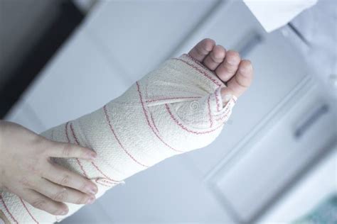 Doctor Patient Plaster Cast Stock Image Image Of Medical Injury