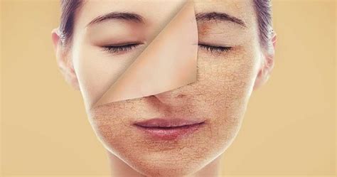 Why Exfoliation Is Important For Skin