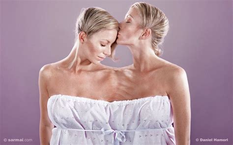 Erwachsene Weibliche Miteinander Verbundene Zwillinge Nackt Zunahme