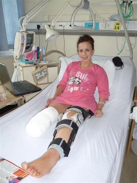 A Holidaymaker Who Had To Have Her Leg Amputated Has Been Handed A Payout Six Years Later