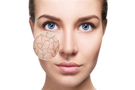 Dry Skin Lets Get Rid Of Patchy Skin 3d Lifestyle Pk