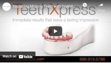 Teethxpress Utica Ny Teeth In A Day Dental Implant