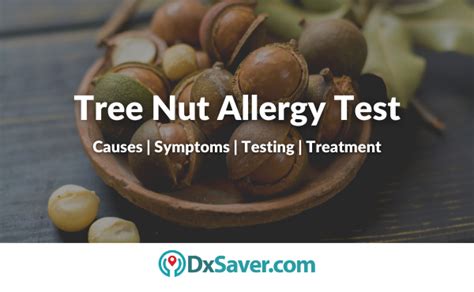 Nut Allergy Causes Symptoms Risk Factor Testing And Treatment