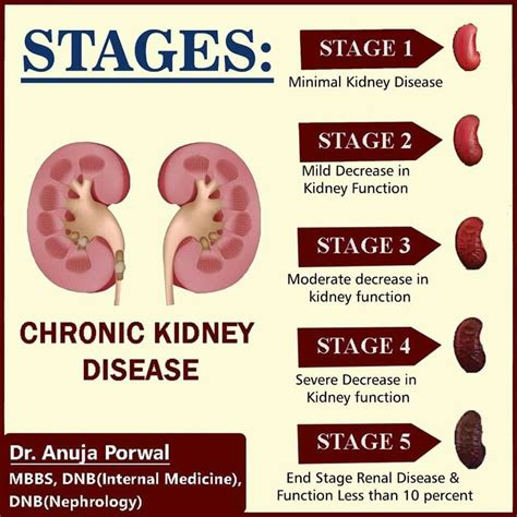 What Is 3 Stage Kidney Disease