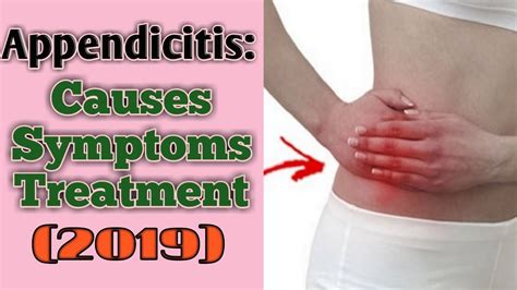 What Is Appendix What Is Appendicitis What Is Appendix Pain Causes