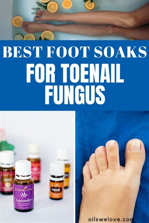 The Best Foot Soaks For Toenail Fungus Including Diy Recipes Toenail Fungus Essential Oils